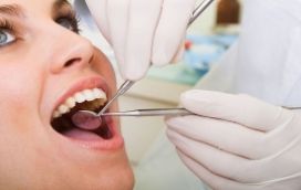 Bảo dưỡng Implant sau cấy ghép