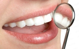 PHỤC HÌNH RĂNG SỨ THẨM MỸ