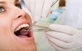 Bảo dưỡng Implant sau cấy ghép